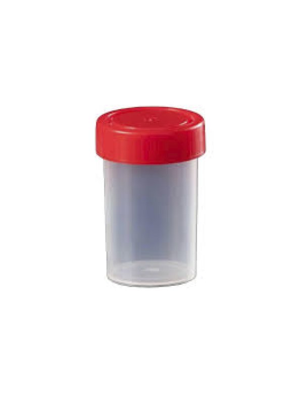 Recipiente para Muestras de Orina